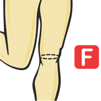 Knee Circumference