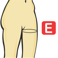 Thigh Circumference